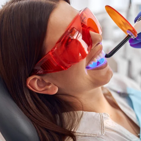 Teeth Whitening